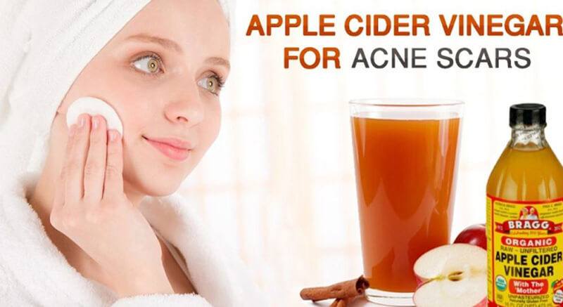 Apple Cider Vinegar Benefits